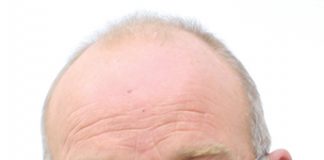 McEwen resigns from council due to residency issue