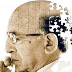 Alzheimers