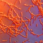Anthrax confirmed in RM of South Qu’Appelle