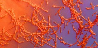 Anthrax confirmed in RM of South Qu’Appelle