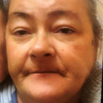 Karen Joy Ireland inquest rules death accidental, failures exposed in care